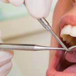 Dentists and Teeth Whitening