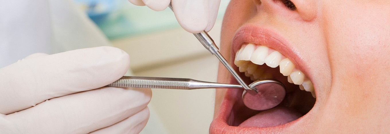 Dentists and Teeth Whitening